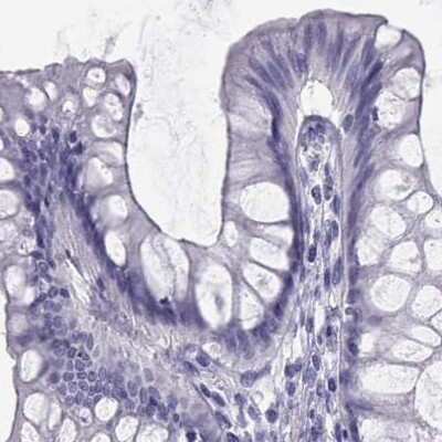 Immunohistochemistry-Paraffin: Semenogelin I Antibody [NBP2-62646] - Staining of human colon.