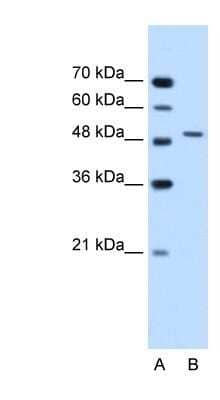 Western Blot: Semenogelin I Antibody [NBP1-58013] - Jurkat cell lysate, Antibody Titration: 1.25ug/ml