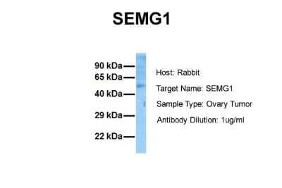 Western Blot: Semenogelin I Antibody [NBP1-58013] - Sample Tissue: Human Ovary Tumor Antibody Dilution: 1.0 ug/ml