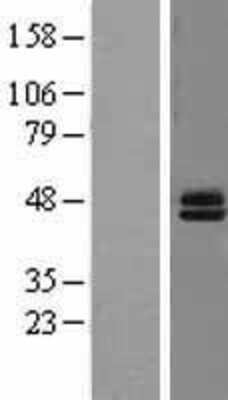 Western Blot: Semenogelin I Overexpression Lysate (Adult Normal) [NBL1-15806] Left-Empty vector transfected control cell lysate (HEK293 cell lysate); Right -Over-expression Lysate for Semenogelin I.