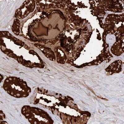 Immunohistochemistry-Paraffin: Semenogelin II Antibody [NBP1-92377] - Staining of human seminal vesicle shows high expression.