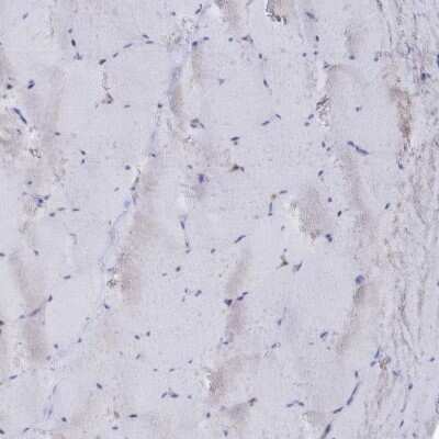 Immunohistochemistry-Paraffin: Semenogelin II Antibody [NBP1-92377] - Staining of human skeletal muscle shows low expression as expected.