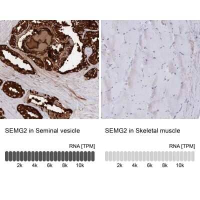 <b>Orthogonal Strategies Validation. </b>Immunohistochemistry-Paraffin: Semenogelin II Antibody [NBP1-92377] - Staining in human seminal vesicle and skeletal muscle tissues using anti-SEMG2 antibody. Corresponding SEMG2 RNA-seq data are presented for the same tissues.