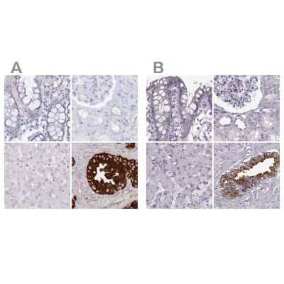 <b>Independent Antibodies Validation. </b>Immunohistochemistry-Paraffin: Semenogelin II Antibody [NBP1-92377] - Staining of human colon, kidney, liver and seminal vesicle using Anti-SEMG2 antibody NBP1-92377 (A) shows similar protein distribution across tissues to independent antibody NBP1-92376 (B).