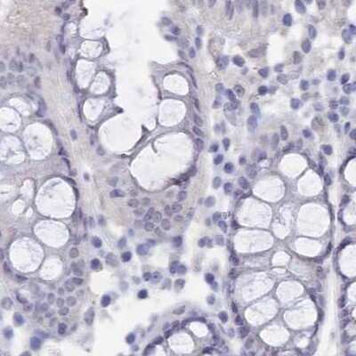 Immunohistochemistry-Paraffin: Semenogelin II Antibody [NBP1-92377] - Staining of human colon.