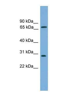 Western Blot: Semenogelin II Antibody [NBP1-80501] - COLO205 cells lysate, concentration 0.2-1 ug/ml.