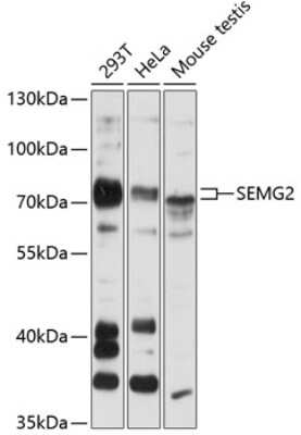 Western Blot: Semenogelin II Antibody [NBP2-93405] - Analysis of extracts of various cell lines, using Semenogelin II at 1:3000 dilution. Secondary antibody: HRP Goat Anti-Rabbit IgG (H+L) at 1:10000 dilution. Lysates/proteins: 25ug per lane. Blocking buffer: 3% nonfat dry milk in TBST. Detection: ECL Basic Kit . Exposure time: 30s.