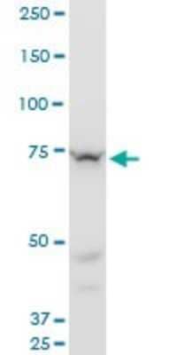 Western Blot: Senataxin Antibody (2A9) [H00023064-M05] - Analysis of SETX expression in PC-12 (Cat # L012V1).