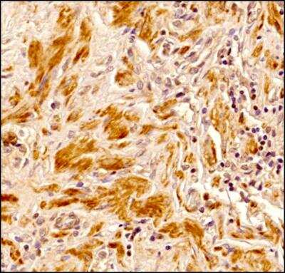 Immunohistochemistry-Paraffin: Senataxin Antibody (4G1) [NBP2-52726] - Senataxin antibody clone 4G1 was tested on human prostate tissue sections and generated strong cytoplasmic-nuclear staining in the secretary/basal epithelial cells as well as the dense connective tissue.