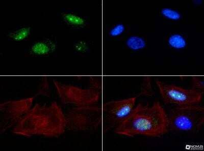 Immunocytochemistry/Immunofluorescence: Senataxin Antibody [NBP1-94712] - Senataxin antibody was tested at 1:100 in HeLa cells with FITC (green). Nuclei and actin were counterstained with DAPI (blue) and Phalloidin (red). 