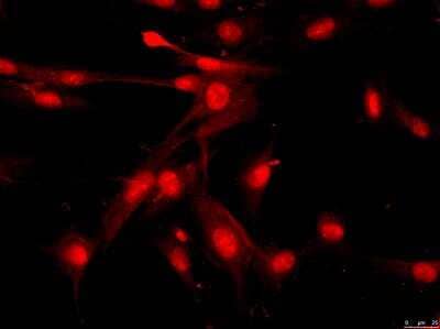 Immunocytochemistry/Immunofluorescence: Senataxin Antibody [NBP1-94712] - Senataxin immunofluorescence in fibroblasts. Image from verified customer review.