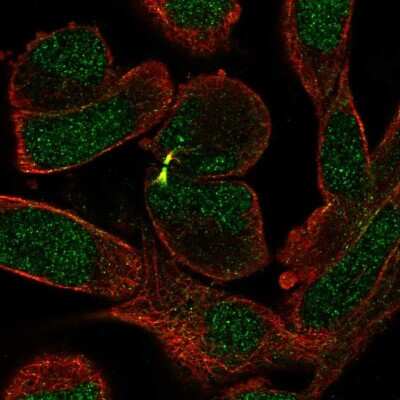 Immunocytochemistry/Immunofluorescence: Senataxin Antibody [NBP2-13300] - Staining of human cell line RH-30 shows localization to nucleus & cytokinetic bridge. Antibody staining is shown in green.