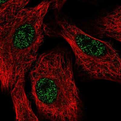 Immunocytochemistry/Immunofluorescence: Senataxin Antibody [NBP2-58495] - Staining of human cell line A549 shows localization to nucleoplasm.