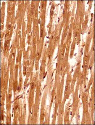 Immunohistochemistry-Paraffin: Senataxin Antibody [NBP1-94712] - Analysis of a FFPE tissue section of human heart (verticle section) using 1:200 dilution of lot A2 of Senataxin antibody. The antibody generated a very strong staining in the cytoplasm and the nuclei of the muscle cells. No signal was found in the perimysium and endomycium (connective tissue) of the section.