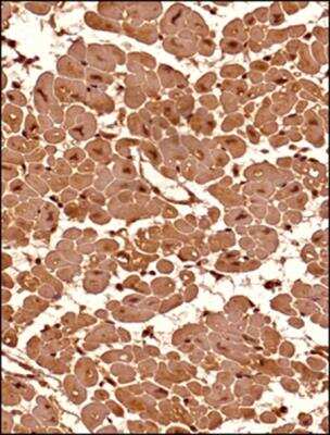 Immunohistochemistry-Paraffin: Senataxin Antibody [NBP1-94712] - Analysis of a FFPE tissue section of human heart (transverse section) using 1:200 dilution of lot A2 of Senataxin antibody. The antibody generated a very strong staining in the cytoplasm and the nuclei of the muscle cells. No signal was found in the perimysium and endomycium area (connective tissue) of the section.