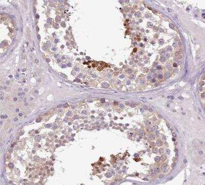 Immunohistochemistry-Paraffin: Senataxin Antibody [NBP2-13300] - Staining of human testis shows strong nuclear positivity in a subset of cells in seminiferous ducts.