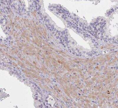 Immunohistochemistry-Paraffin: Senataxin Antibody [NBP2-13300] - Staining of human prostate shows moderate cytoplasmic positivity in smooth muscle cells.