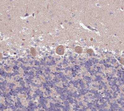 Immunohistochemistry-Paraffin: Senataxin Antibody [NBP2-13300] - Staining of human cerebellum shows weak cytoplasmic positivity in Purkinje cells.