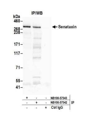 <b>Independent Antibodies Validation. </b>Immunoprecipitation: Senataxin Antibody [NB100-57542] - Detection of human Senataxin by western blot of immunoprecipitates. Samples: Whole cell lysate (1.0 mg per IP reaction; 20% of IP loaded) from HeLa cells prepared using NETN lysis buffer. Antibodies: Affinity purified rabbit anti-Senataxin antibody NB100-57542 used for IP at 3 ug per reaction. Senataxin was also immunoprecipitated by rabbit anti-Senataxin antibody NB100-57543. For blotting immunoprecipitated Senataxin, NB100-57542 was used at 1 ug/ml. Detection: Chemiluminescence with an exposure time of 30 seconds.