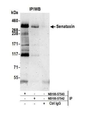 <b>Independent Antibodies Validation. </b>Immunoprecipitation: Senataxin Antibody [NB100-57543] - Detection of human Senataxin by western blot of immunoprecipitates. Samples: Whole cell lysate (0.5 or 1.0 mg per IP reaction; 20% of IP loaded) from HeLa cells prepared using NETN lysis buffer. Antibodies: Affinity purified rabbit anti-Senataxin antibody NB100-57543 used for IP at 6 ug per reaction. Senataxin was also immunoprecipitated by rabbit anti-Senataxin antibody NB100-57542. For blotting immunoprecipitated Senataxin, NB100-57543 was used at 1 ug/ml. Detection: Chemiluminescence with an exposure time of 3 minutes.