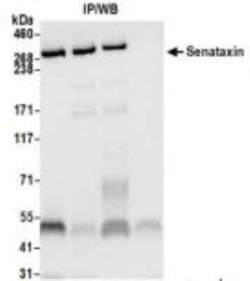 Immunoprecipitation: Senataxin Antibody [NBP3-14676] - Whole cell lysate (1.0 mgper IP reaction; 20% of IP loaded) from HeLa cells preparedusing NETN lysis buffer. Antibodies: Rabbit anti-Senataxinrecombinant monoclonal antibody  used for IP at 6 ul per reaction. Senataxin was also immunoprecipitated by rabbit anti-Senataxin antibodies. For blottingimmunoprecipitated Senataxin, was used at1:1000. Chemiluminescence with an exposure time of 10seconds.