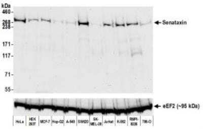 Western Blot: Senataxin Antibody [NBP3-14676] - Whole cell lysate (50 ug) from HeLa, HEK293T, MCF-7,Hep-G2, A-549, SW620, SK-MEL-28, Jurkat, K-562,RMPI-8226, and 786-O cells prepared using NETN lysisbuffer. Antibody: Rabbit anti-Senataxin recombinantmonoclonal antibody  used at 1:1000. Secondary: HRP-conjugated goat anti-rabbit IgG. Chemiluminescence with an exposure timeof 30 seconds.