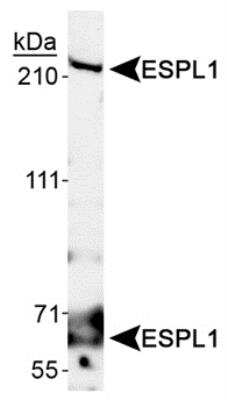 Western Blot: Separase Antibody [NB110-85460] - Detection of ESPL1 isoforms 1 and 2 in A431 whole cell lysates using NB110-85460.
