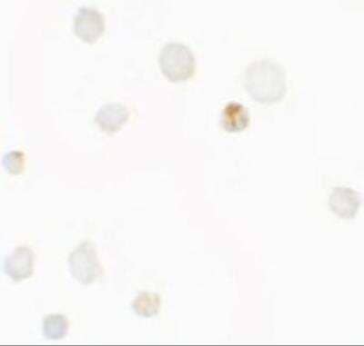 Immunocytochemistry/Immunofluorescence: Septin-1 Antibody [NBP2-81892] - Analysis of Septin-1 in Raji cells with Septin-1 antibody at 5 ug/ml.