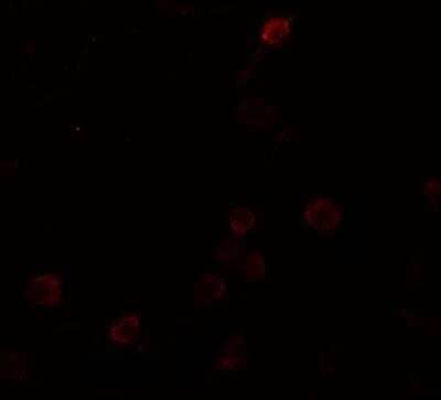 Immunocytochemistry/Immunofluorescence: Septin-1 Antibody [NBP2-81892] - Analysis of Septin-1 in Raji cells with Septin-1 antibody at 20 ug/ml.
