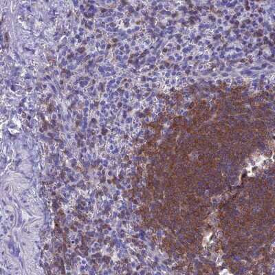 Immunohistochemistry-Paraffin: Septin-1 Antibody [NBP1-84251] - Staining of human spleen shows high expression.