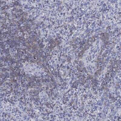Immunohistochemistry-Paraffin: Septin-1 Antibody [NBP3-17043] - Staining of human spleen shows high expression.
