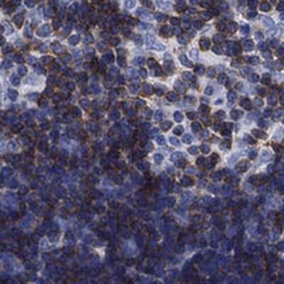 Immunohistochemistry-Paraffin: Septin-1 Antibody [NBP3-17043] - Staining of human thymus shows cytoplasmc positivity in cortical and medullary cells.