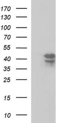 Western Blot: Septin-1 Antibody (OTI1E1) - Azide and BSA Free [NBP2-74072] - Analysis of HEK293T cells were transfected with the pCMV6-ENTRY control (Left lane) or pCMV6-ENTRY Septin 1.