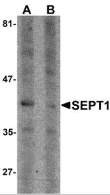 Western Blot: Septin-1 Antibody [NBP2-81892] - Analysis of Septin-1 in Raji cell lysate with Septin-1 antibody at 1 ug/ml in (A) the absence and (B) presence of blocking peptide.