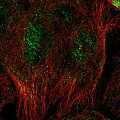 Immunocytochemistry/Immunofluorescence: Septin-10 Antibody [NBP2-56929] - Staining of human cell line A-431 shows localization to nucleus & actin filaments.