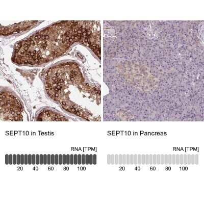 Immunohistochemistry-Paraffin Septin-10 Antibody