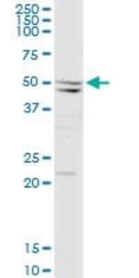 Western Blot: Septin-10 Antibody [H00151011-D01P] - Analysis of SEPT10 expression in human liver.