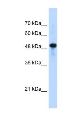 Western Blot: Septin-10 Antibody [NBP1-58106] - Jurkat cell lysate, concentration 1.25ug/ml.