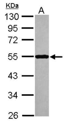 Western Blot: Septin-10 Antibody [NBP2-20298] - Sample (30 ug of whole cell lysate) A: IMR32 10% SDS PAGE gel, diluted at 1:10000.