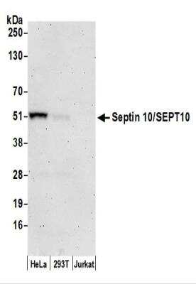 <b>Independent Antibodies Validation and Biological Strategies Validation.</b>Western Blot: Septin-10 Antibody [NBP2-44287] - Samples: Whole cell lysate (50 ug) from HeLa, 293T, and Jurkat cells prepared using NETN lysis buffer.