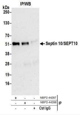 Western Blot: Septin-10 Antibody [NBP2-44287] - Western Blot of Immunoprecipitates. Samples: Whole cell lysate (0.5 or 1.0 mg per IP reaction; 20% of IP loaded) from HeLa cells prepared using NETN lysis buffer. NBP2-44287 was used for IP at 6 ug per reaction. Septin 10/SEPT10 was also immunoprecipitated by another rabbit anti-Septin 10/SEPT10 antibody.