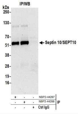 Western Blot: Septin-10 Antibody [NBP2-44288] - Western Blot of Immunoprecipitates. Samples: Whole cell lysate (0.5 or 1.0 mg per IP reaction; 20% of IP loaded) from HeLa cells prepared using NETN lysis buffer. NBP2-44288  used for IP at 6 ug per reaction. Septin 10/SEPT10 was also immunoprecipitated by NBP2-44288.