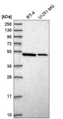 Western Blot Septin-10 Antibody