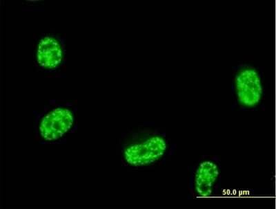 Immunocytochemistry/Immunofluorescence: Septin-12 Antibody [H00124404-B01P] - Analysis of purified antibody to SEPT12 on HeLa cell. (antibody concentration 10 ug/ml)