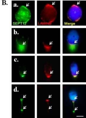 Immunocytochemistry/Immunofluorescence: Septin-12 Antibody [H00124404-B01P] - An IFA revealed multiple localizations of SEPT12 and LAMINB1 signals. A total of 32 male germ cells were were evaluated as (a.) Round spermatids (n = 9; labeled with anti-SEPT12 and anti-LAMINB1 antibodies as the presented figure,9/9); (b.) elongating and (c.) elongated spermatids (n = 11;11/11); (d.) ejaculated spermatozoa (n = 10;10/10). (a.-d.) Anti-SEPT12 antibody (left panel; green), anti-LAMINB1 antibody (middle panel; red), and a combination of the left and middle panels (right panel). The arrow indicates SEPT12 or LAMINB1 signals. Scale bar: 5 um. Image collected and cropped by CiteAb from the following publication (//dx.plos.org/10.1371/journal.pone.0120722) licensed under a CC-BY license.