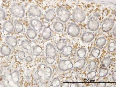 Immunohistochemistry-Paraffin: Septin-12 Antibody [H00124404-B01P] - Analysis of purified antibody to SEPT12 on formalin-fixed paraffin-embedded human colon. (antibody concentration 3 ug/ml)