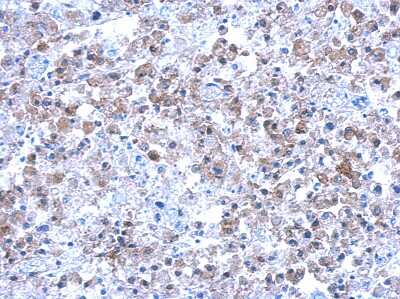 Immunohistochemistry-Paraffin: Septin-12 Antibody [NBP2-20300] - Immunohistochemical analysis of paraffin-embedded hela xenograft, using antibody at 1:500 dilution.