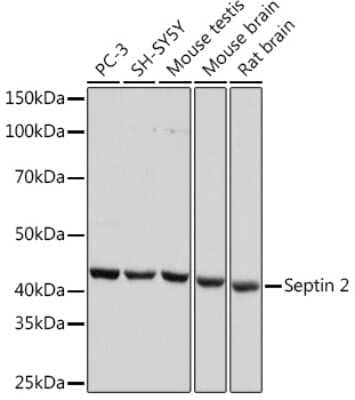 Western Blot: Septin-2 Antibody (9N1B3) [NBP3-16653] - Western blot analysis of extracts of various cell lines, using Septin-2 Rabbit mAb (NBP3-16653) at 1:1000 dilution. Secondary antibody: HRP Goat Anti-Rabbit IgG (H+L) at 1:10000 dilution. Lysates/proteins: 25ug per lane. Blocking buffer: 3% nonfat dry milk in TBST. Detection: ECL Basic Kit. Exposure time: 10s.