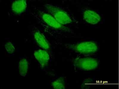 Immunocytochemistry/Immunofluorescence: Septin-2 Antibody [H00004735-B01P] - Analysis of purified antibody to SEPT2 on HeLa cell. (antibody concentration 10 ug/ml)