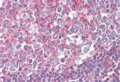 Immunohistochemistry-Paraffin: Septin-2 Antibody [NBP1-06076] - Staining of paraffin embedded Human Tonsil tissue. Antibody at 2.5 ug/mL. Steamed antigen retrieval with citrate buffer pH 6, AP-staining.